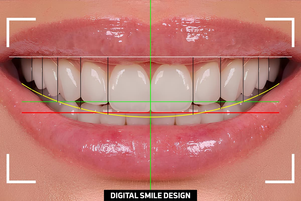 The Role of Digital Imaging in Smile Design Dentistry